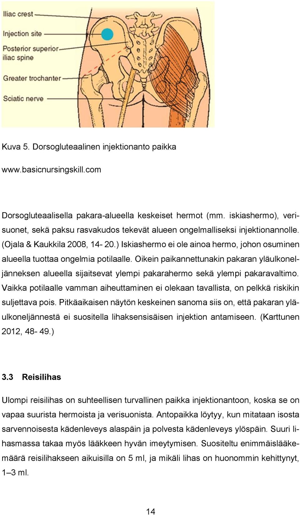 ) Iskiashermo ei ole ainoa hermo, johon osuminen alueella tuottaa ongelmia potilaalle.