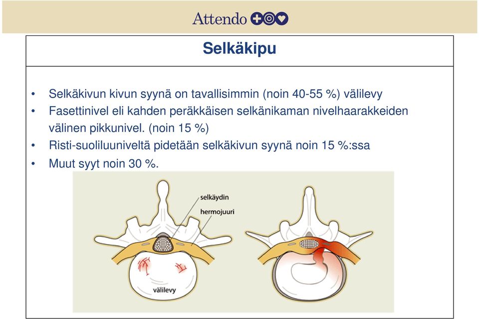 nivelhaarakkeiden välinen pikkunivel.