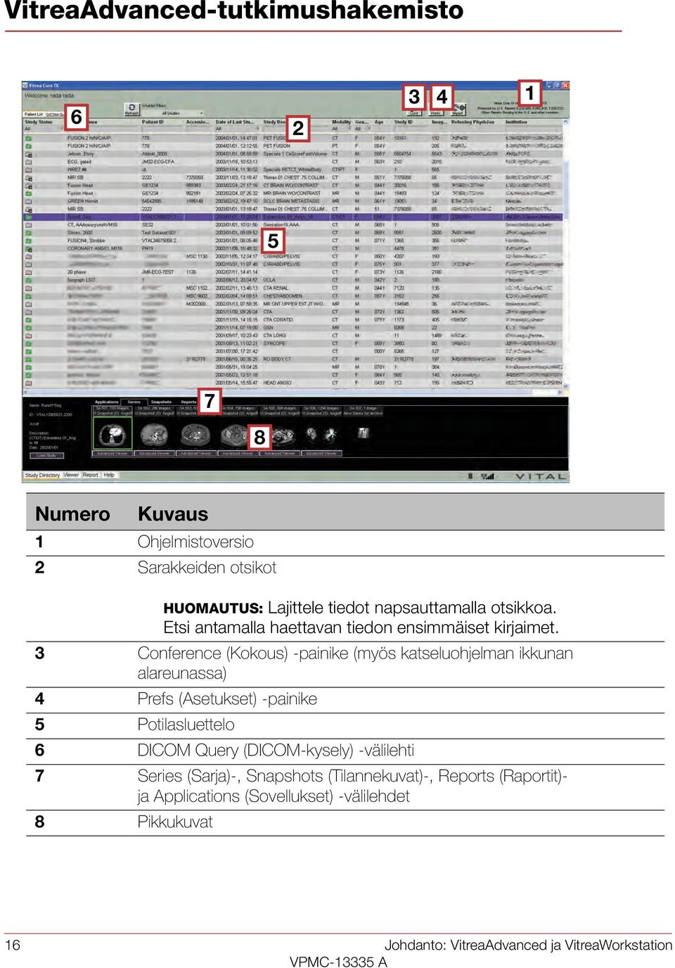 3 Conference (Kokous) -painike (myös katseluohjelman ikkunan alareunassa) 4 Prefs (Asetukset) -painike 5 Potilasluettelo 6 DICOM Query