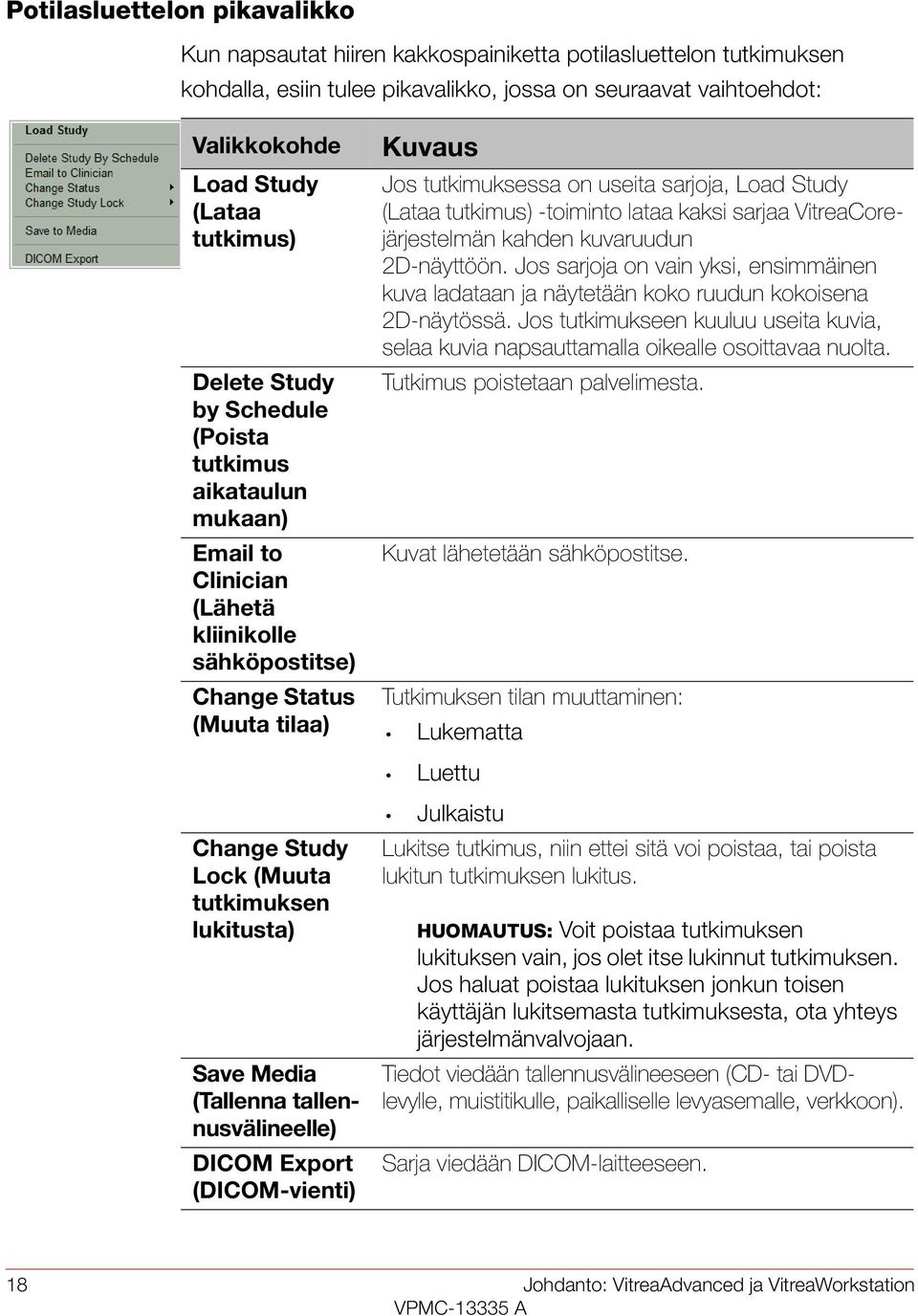 Load Study (Lataa tutkimus) -toiminto lataa kaksi sarjaa VitreaCorejärjestelmän kahden kuvaruudun 2D-näyttöön.