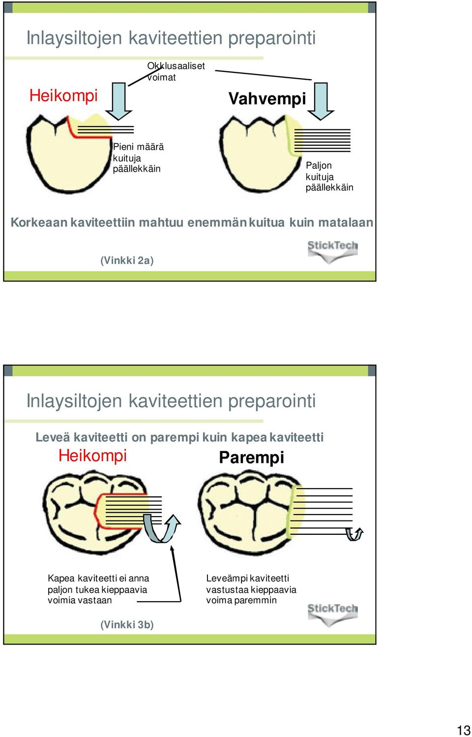 kaviteettien preparointi Leveä kaviteetti on parempi kuin kapea kaviteetti Heikompi Parempi Kapea kaviteetti ei