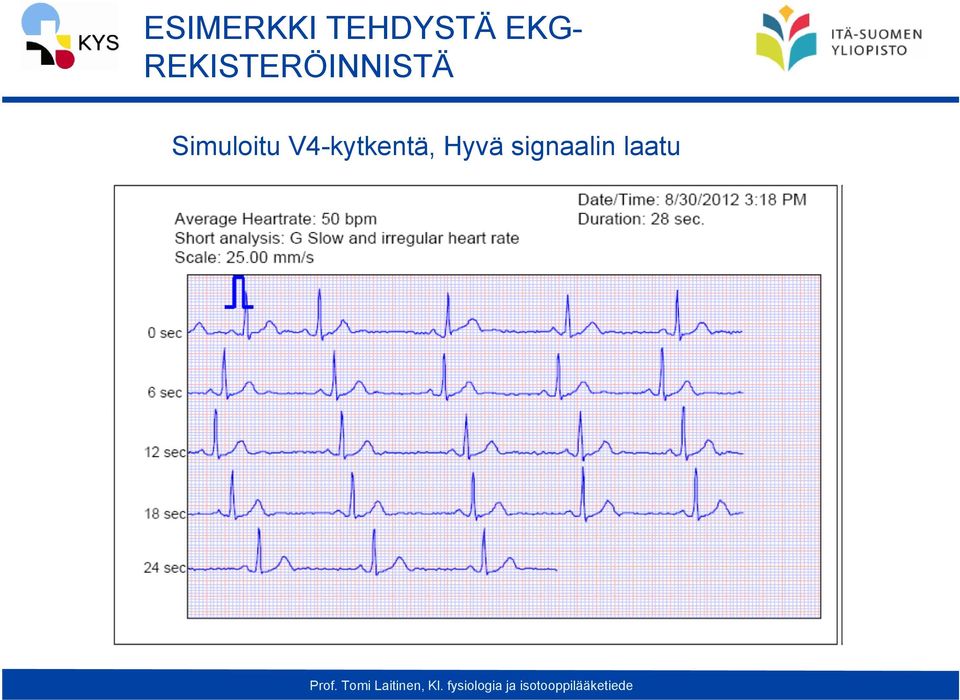 REKISTERÖINNISTÄ