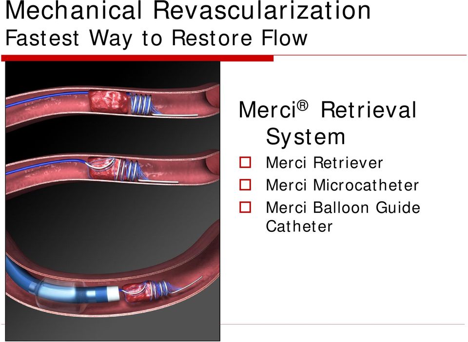 Retrieval System Merci Retriever