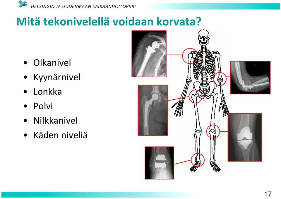 Olkanivel Kyynärnivel