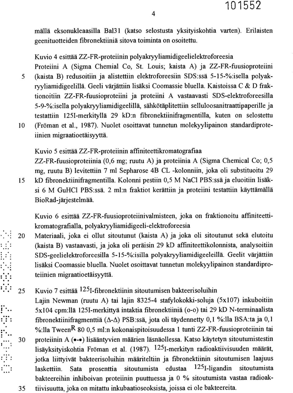 Louis; kaista A) ja ZZ-FR-fuusioproteiini 5 (kaista B) redusoitiin ja alistettiin elektroforeesiin SDS:ssä 5-15-%:isella polyakryyliamidigeelillä. Geeli värjättiin lisäksi Coomassie bluella.