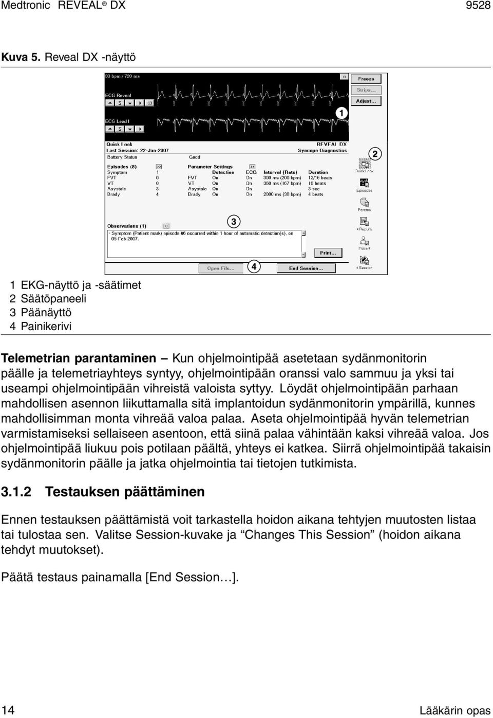 ohjelmointipään oranssi valo sammuu ja yksi tai useampi ohjelmointipään vihreistä valoista syttyy.