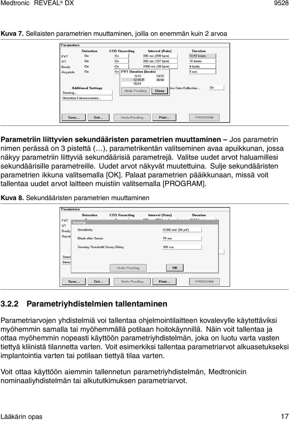 valitseminen avaa apuikkunan, jossa näkyy parametriin liittyviä sekundäärisiä parametrejä. Valitse uudet arvot haluamillesi sekundäärisille parametreille. Uudet arvot näkyvät muutettuina.