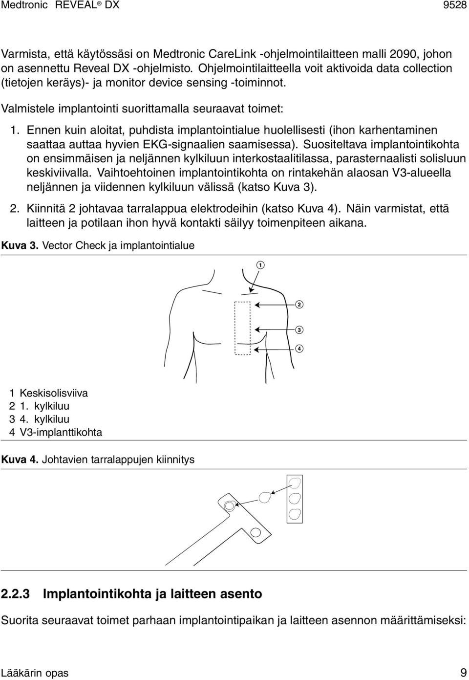 Ennen kuin aloitat, puhdista implantointialue huolellisesti (ihon karhentaminen saattaa auttaa hyvien EKG-signaalien saamisessa).