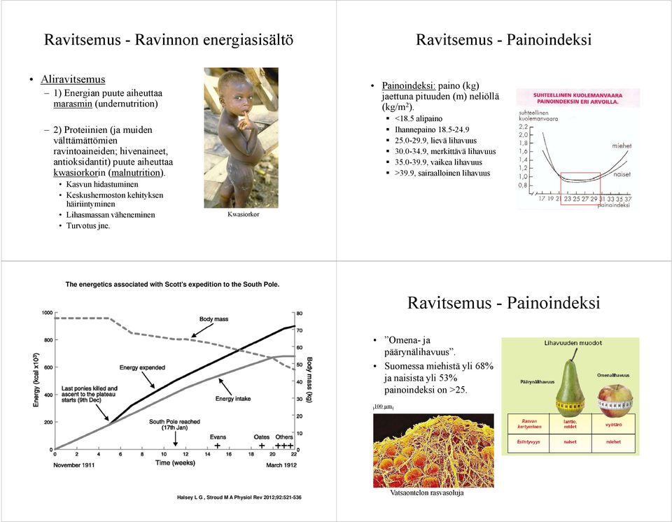 Kwasiorkor Pi Painoindeksi: idkipaino (kg) jaettuna pituuden (m) neliöllä (kg/m 2 ). <18.5 alipaino Ihannepaino 18.5-24.9 25.0-29.9, lievä lihavuus 30.0-34.9, merkittävä lihavuus 35.0-39.