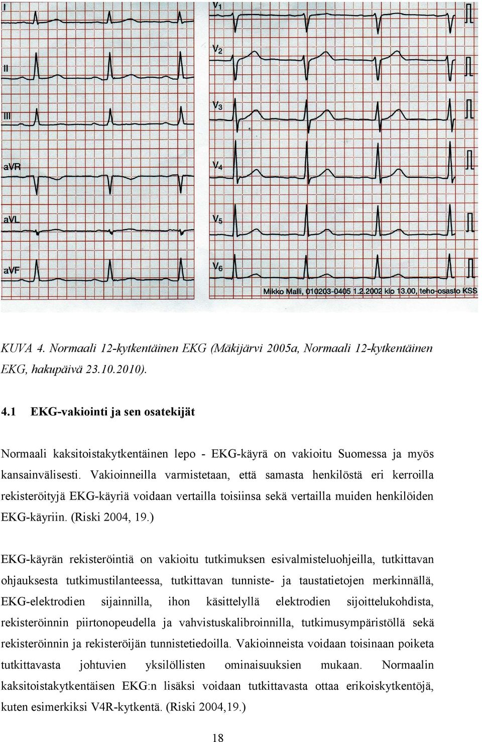 ) EKG-käyrän rekisteröintiä on vakioitu tutkimuksen esivalmisteluohjeilla, tutkittavan ohjauksesta tutkimustilanteessa, tutkittavan tunniste- ja taustatietojen merkinnällä, EKG-elektrodien