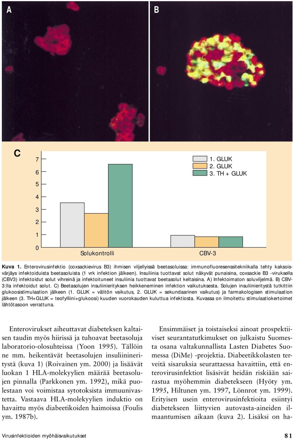 Insuliinia tuottavat solut näkyvät punaisina, coxsackie B3 -viruksella (CBV3) infektoidut solut vihreinä ja infektoituneet insuliinia tuottavat beetasolut keltaisina. A) Infektoimaton soluviljelmä.