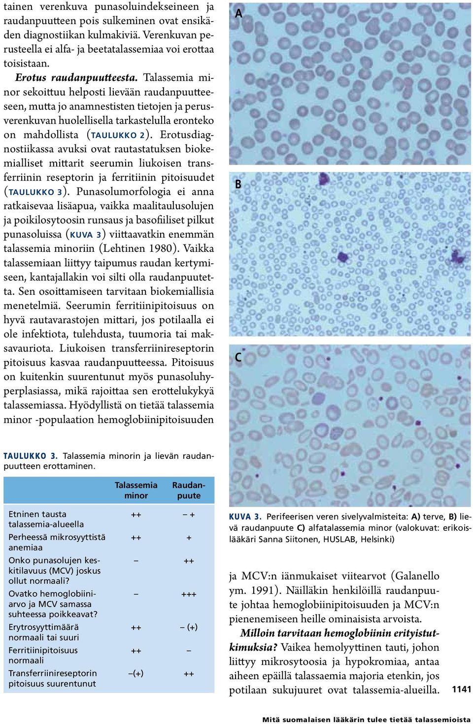 Talassemia minor sekoittuu helposti lievään raudanpuutteeseen, mutta jo anamnestisten tietojen ja perusverenkuvan huolellisella tarkastelulla eronteko on mahdollista (taulukko 2).