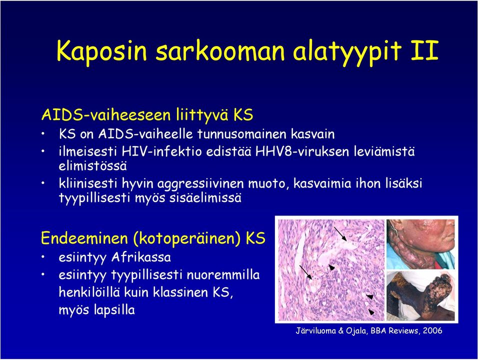 muoto, kasvaimia ihon lisäksi tyypillisesti myös sisäelimissä Endeeminen (kotoperäinen) KS esiintyy