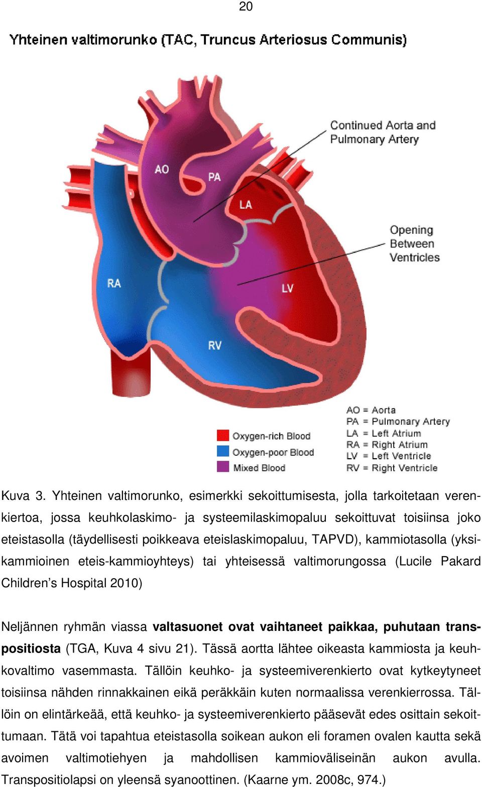 eteislaskimopaluu, TAPVD), kammiotasolla (yksikammioinen eteis-kammioyhteys) tai yhteisessä valtimorungossa (Lucile Pakard Children s Hospital 2010) Neljännen ryhmän viassa valtasuonet ovat