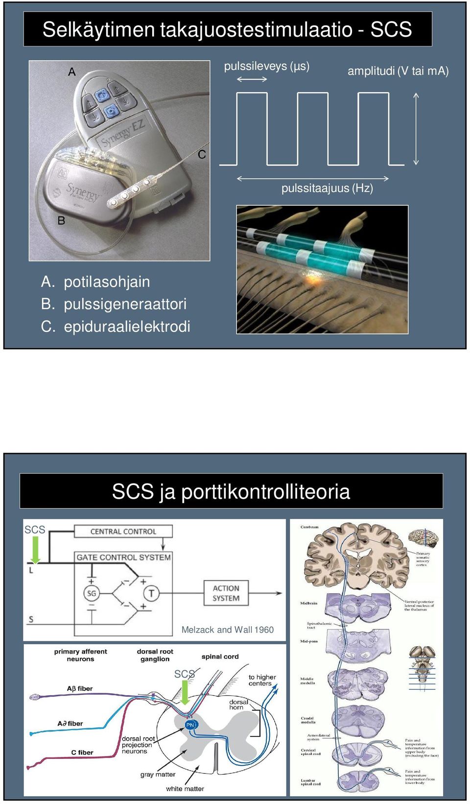 epiduraalielektrodi SCS ja porttikontrolliteoria SCS - kipureseptorit -