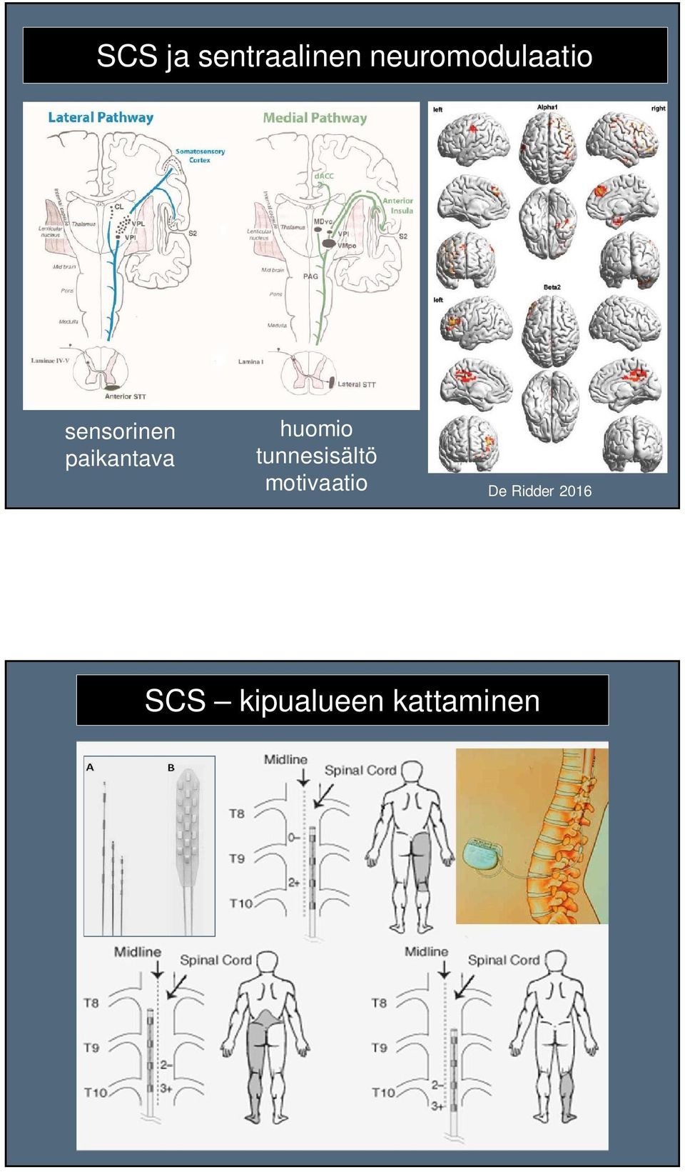 paikantava huomio tunnesisältö