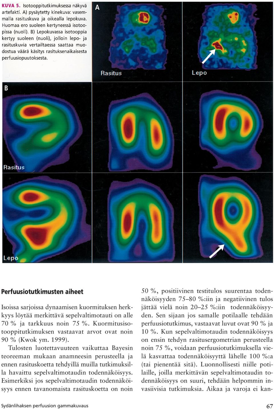 A B Perfuusiotutkimusten aiheet Isoissa sarjoissa dynaamisen kuormituksen herkkyys löytää merkittävä sepelvaltimotauti on alle 70 % ja tarkkuus noin 75 %.