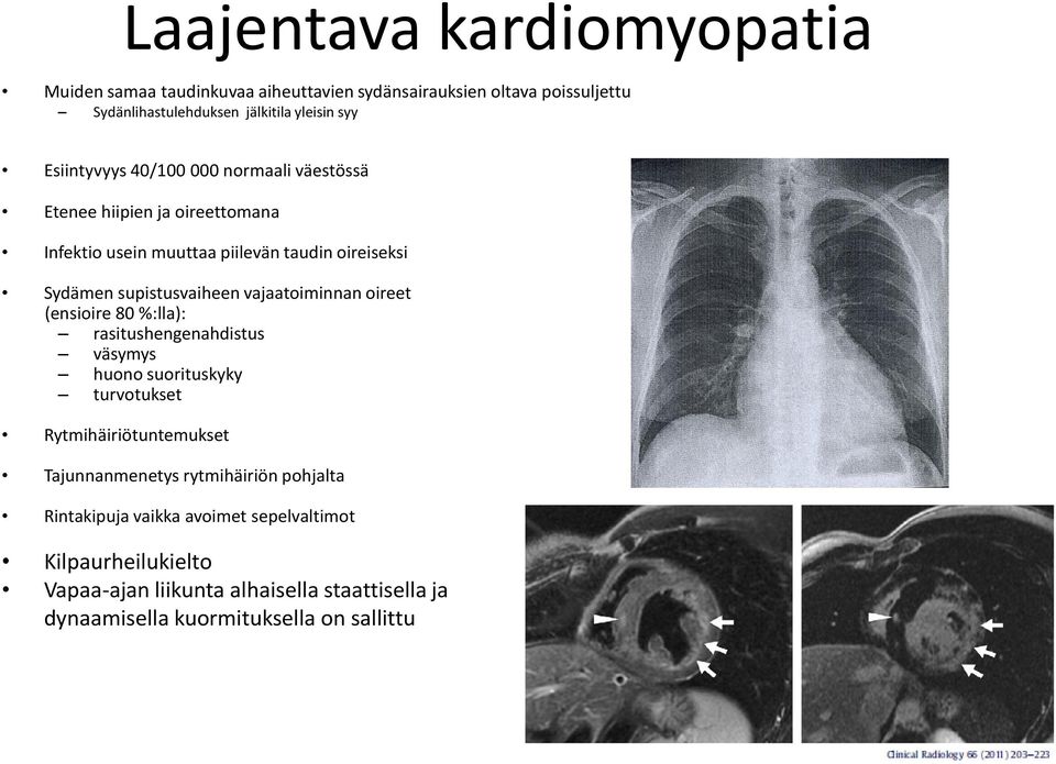 vajaatoiminnan oireet (ensioire 80 %:lla): rasitushengenahdistus väsymys huono suorituskyky turvotukset Rytmihäiriötuntemukset Tajunnanmenetys