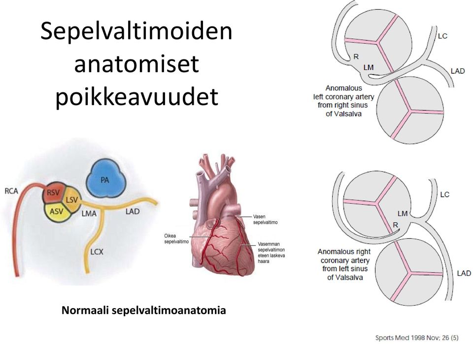 poikkeavuudet