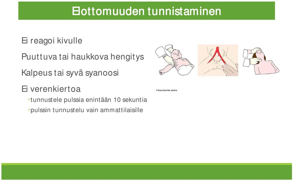 syanoosi Ei verenkiertoa tunnustele pulssia