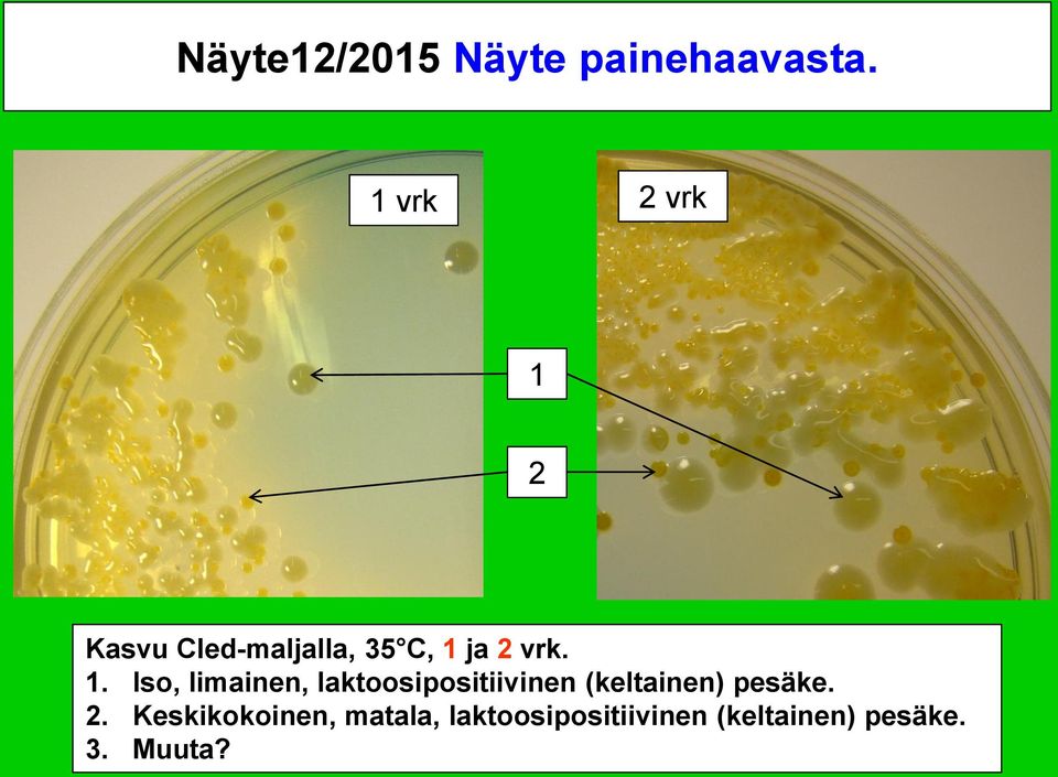 1. Iso, limainen, laktoosipositiivinen (keltainen)