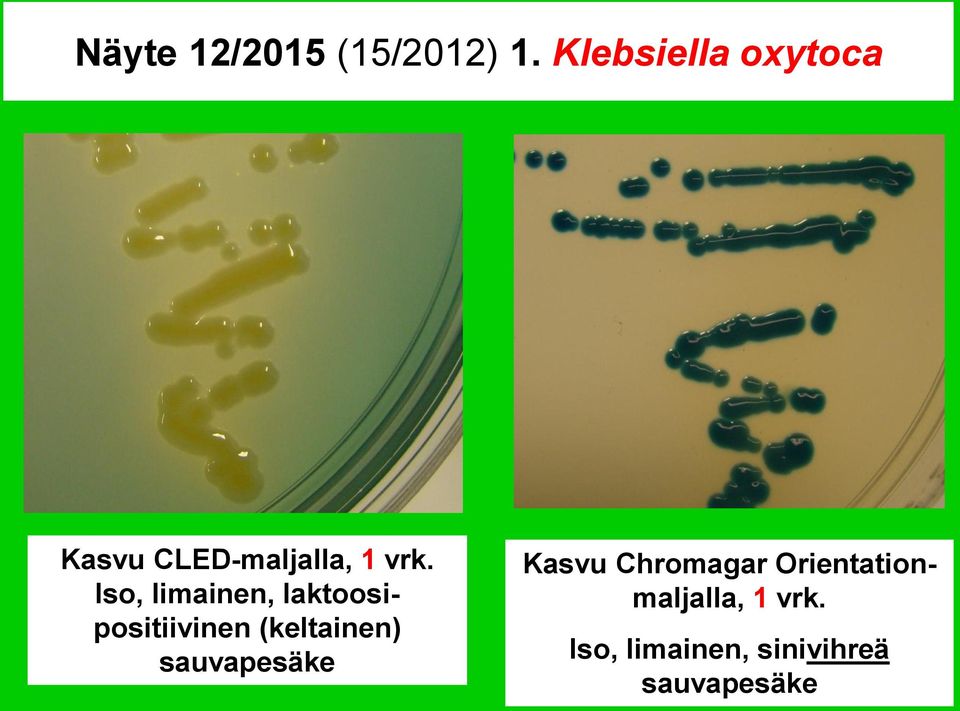 Iso, limainen, laktoosipositiivinen (keltainen)