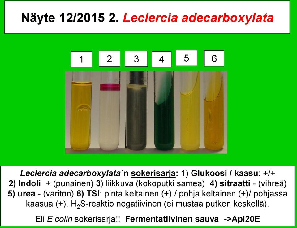 +/+ 2) Indoli + (punainen) 3) liikkuva (kokoputki samea) 4) sitraatti - (vihreä) 5) urea - (väritön)