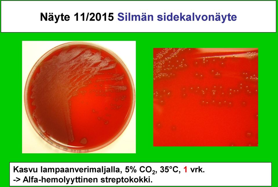 lampaanverimaljalla, 5% CO 2,