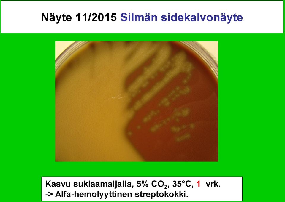 suklaamaljalla, 5% CO 2, 35