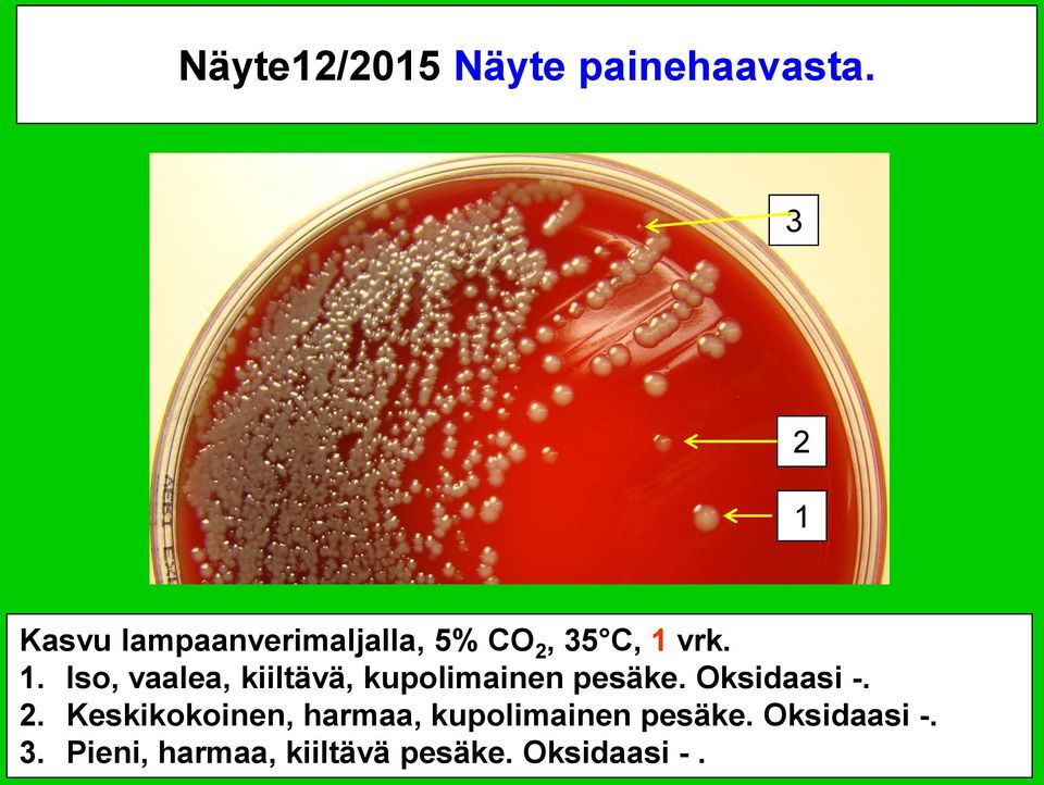 Oksidaasi -. 2. Keskikokoinen, harmaa, kupolimainen pesäke.