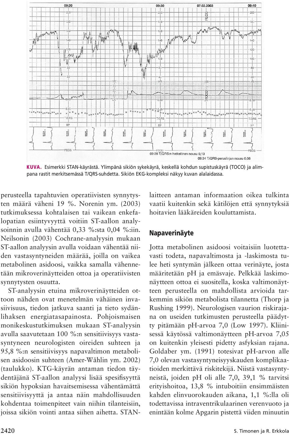 (2003) tutkimuksessa kohtalaisen tai vaikean enkefalopatian esiintyvyyttä voitiin ST-aallon analysoinnin avulla vähentää 0,33 %:sta 0,04 %:iin.