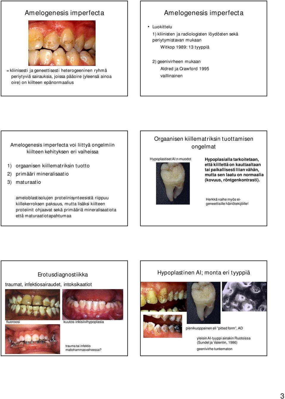 kiilteen kehityksen eri vaiheissa Orgaanisen kiillematriksin tuottamisen ongelmat 1) orgaanisen kiillematriksin tuotto 2) primääri mineralisaatio 3) maturaatio Hypoplastiset AI:n muodot Hypoplasialla