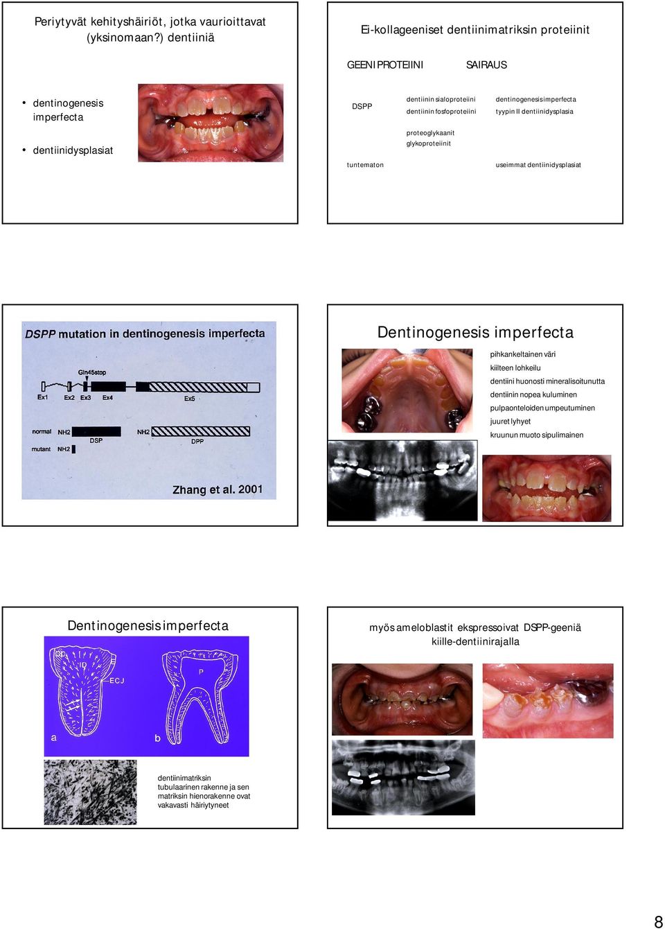 tyypin II dentiinidysplasia dentiinidysplasiat proteoglykaanit glykoproteiinit tuntematon useimmat dentiinidysplasiat Dentinogenesis imperfecta pihkankeltainen väri kiilteen lohkeilu