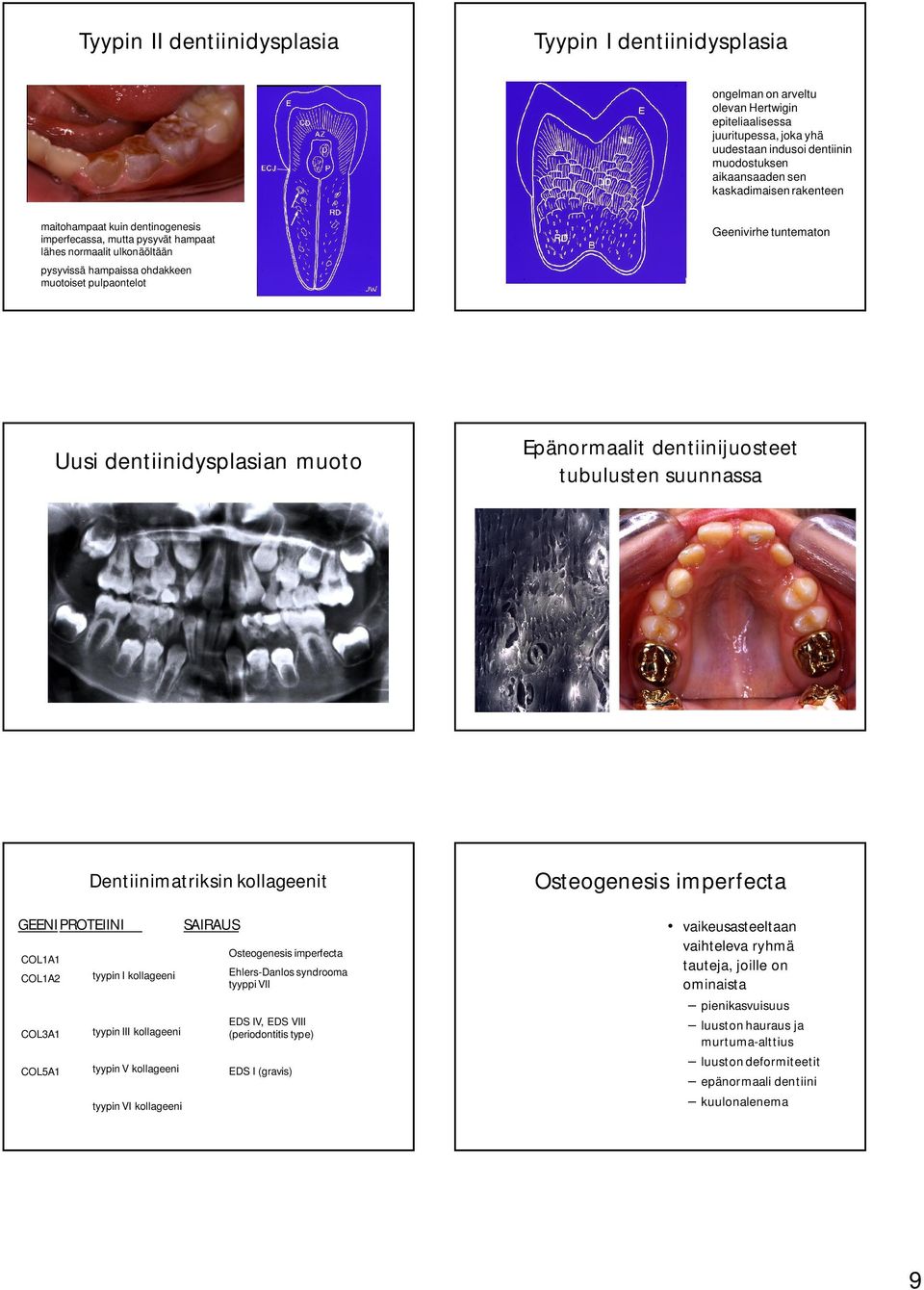 Uusi dentiinidysplasian muoto Epänormaalit dentiinijuosteet tubulusten suunnassa GEENIPROTEIINI COL1A1 COL1A2 COL3A1 COL5A1 Dentiinimatriksin kollageenit tyypin I kollageeni tyypin III kollageeni