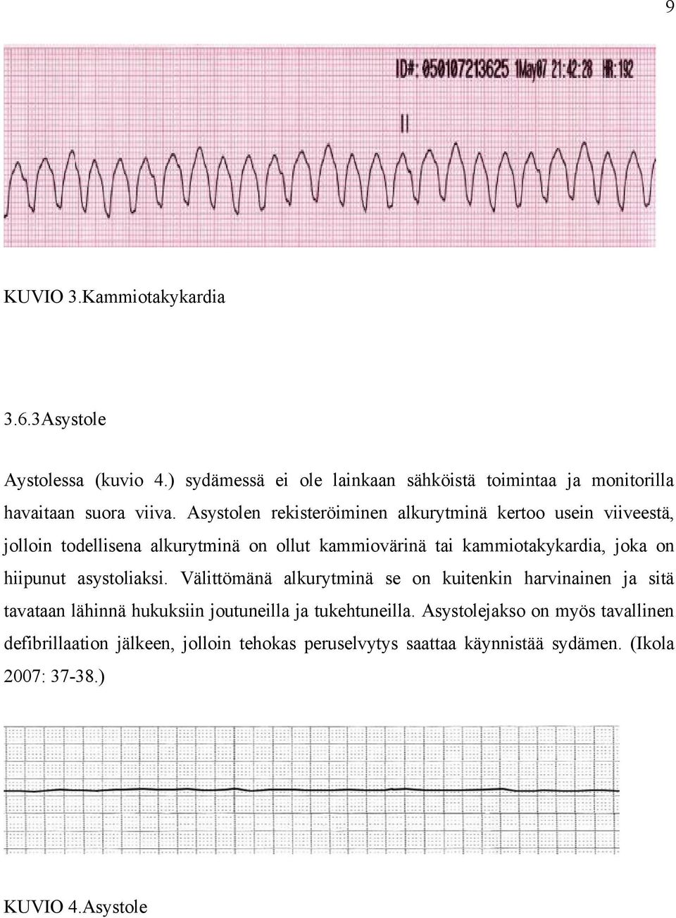 hiipunut asystoliaksi. Välittömänä alkurytminä se on kuitenkin harvinainen ja sitä tavataan lähinnä hukuksiin joutuneilla ja tukehtuneilla.