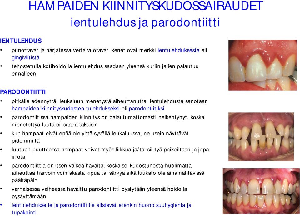 parodontiitiksi parodontiitissa hampaiden kiinnitys on palautumattomasti heikentynyt, koska menetettyä luuta ei saada takaisin kun hampaat eivät enää ole yhtä syvällä leukaluussa, ne usein näyttävät