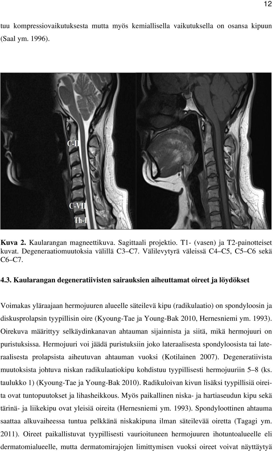 C7. Välilevytyrä väleissä C4 C5, C5 C6 sekä C6 C7. 4.3.