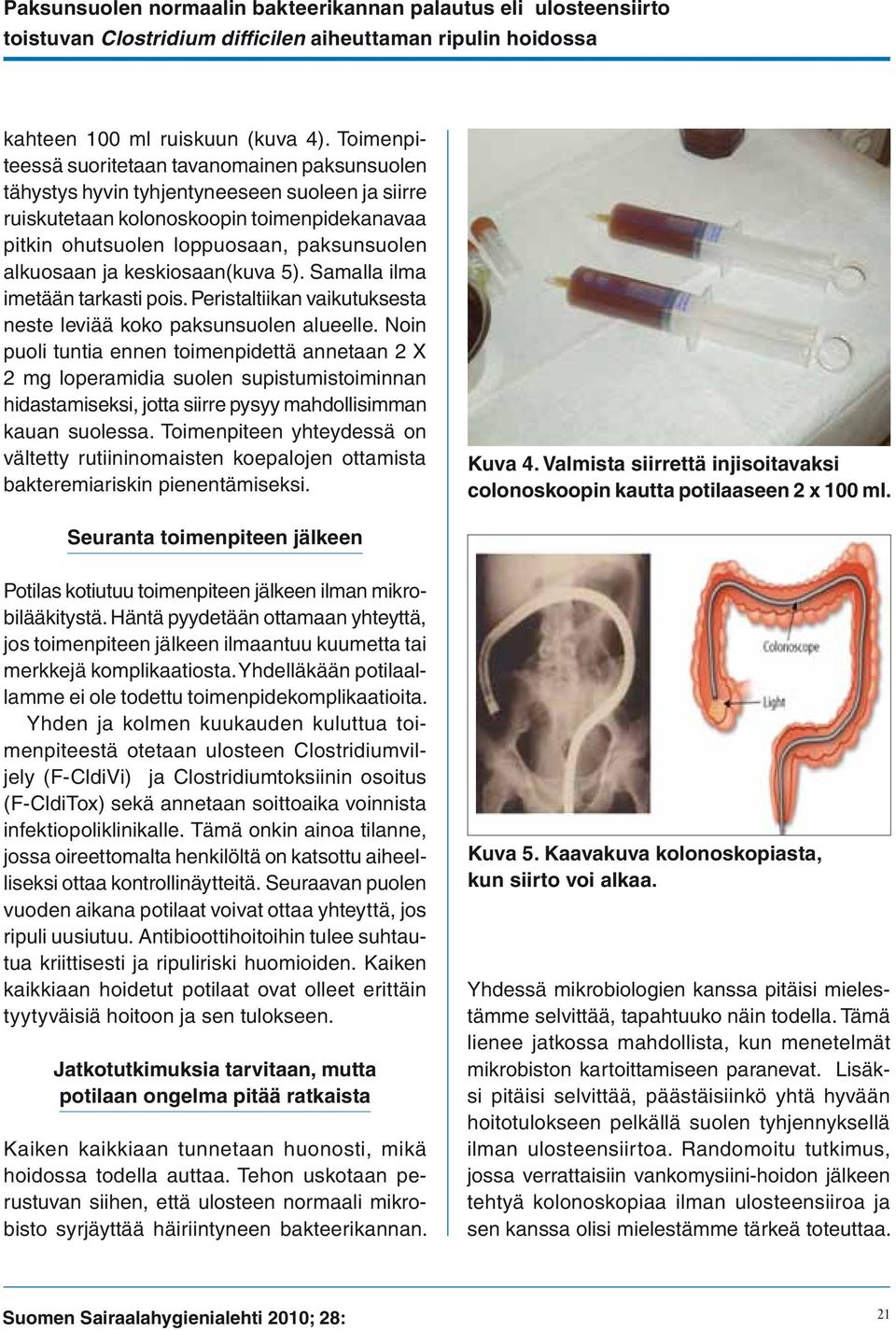 ja keskiosaan(kuva 5). Samalla ilma imetään tarkasti pois. Peristaltiikan vaikutuksesta neste leviää koko paksunsuolen alueelle.