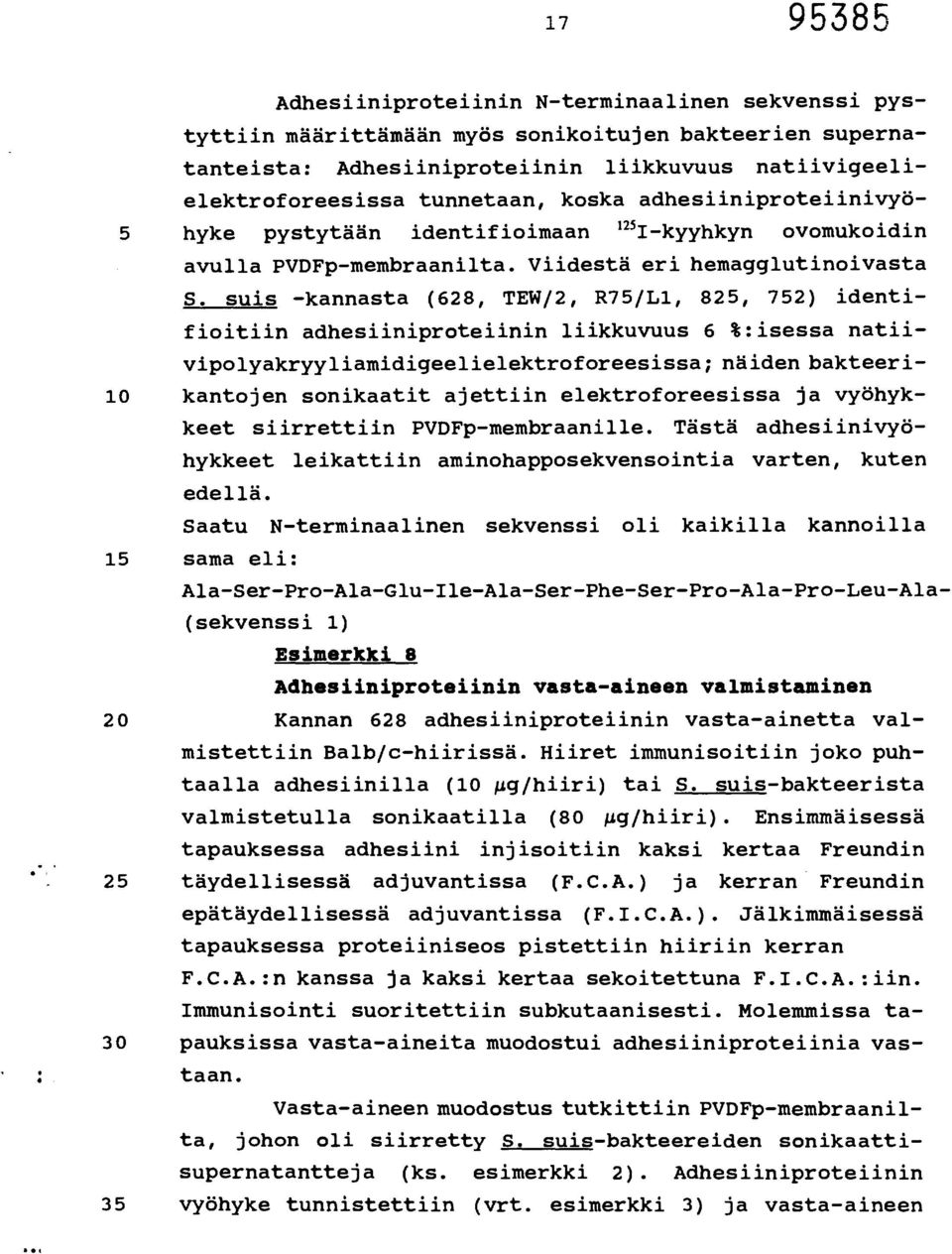 suis -kannasta (628, TEW/2, R75/L1, 825, 752) identifioitiin adhesiiniproteiinin liikkuvuus 6 %:isessa natiivipolyakryyliamidigeelielektroforeesissa;näiden bakteeri- 10 kantojen sonikaatit ajettiin