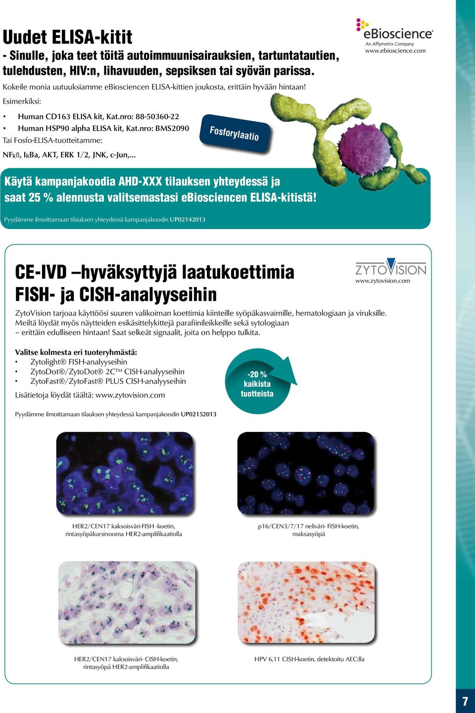 nro: BMS2090 Tai Fosfo-ELISA-tuotteitamme: Fosforylaatio NF k ß, IkBa, AKT, ERK 1/2, JNK, c-jun, Käytä kampanjakoodia AHD-XXX tilauksen yhteydessä ja saat 25 % alennusta valitsemastasi ebiosciencen