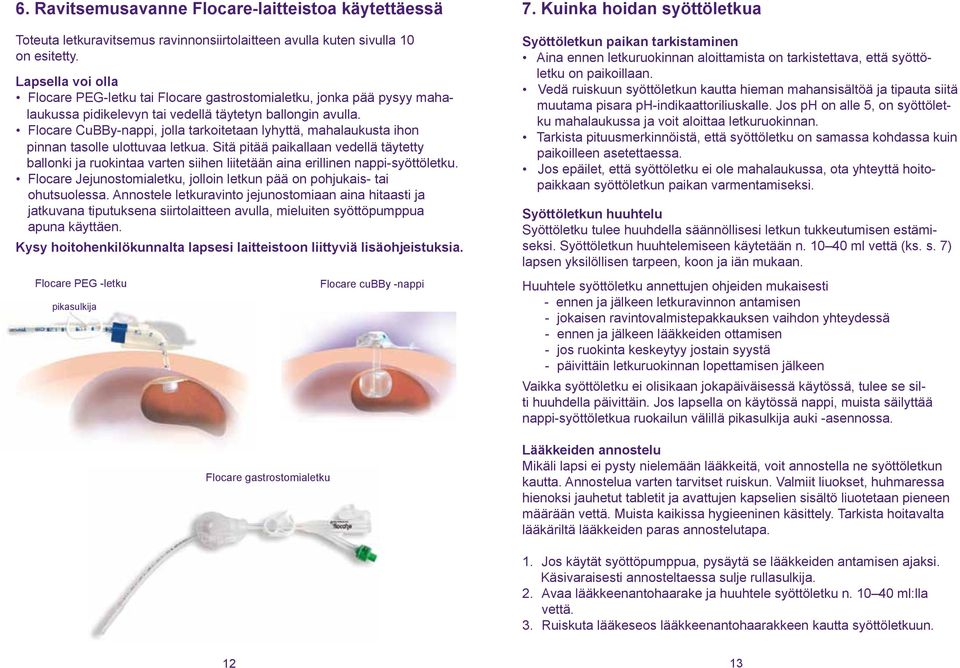 Flocare CuBBy-nappi, jolla tarkoitetaan lyhyttä, mahalaukusta ihon pinnan tasolle ulottuvaa letkua.