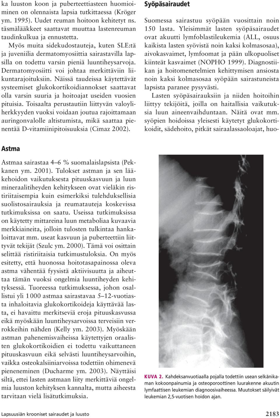 Myös muita sidekudostauteja, kuten SLE:tä ja juveniilia dermatomyosiittia sairastavilla lapsilla on todettu varsin pieniä luuntiheysarvoja.