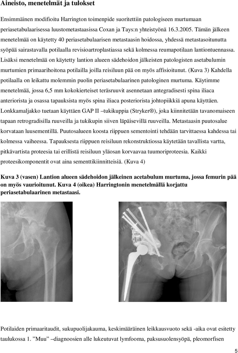 lantiontuennassa. Lisäksi menetelmää on käytetty lantion alueen sädehoidon jälkeisten patologisten asetabulumin murtumien primaarihoitona potilailla joilla reisiluun pää on myös affisioitunut.