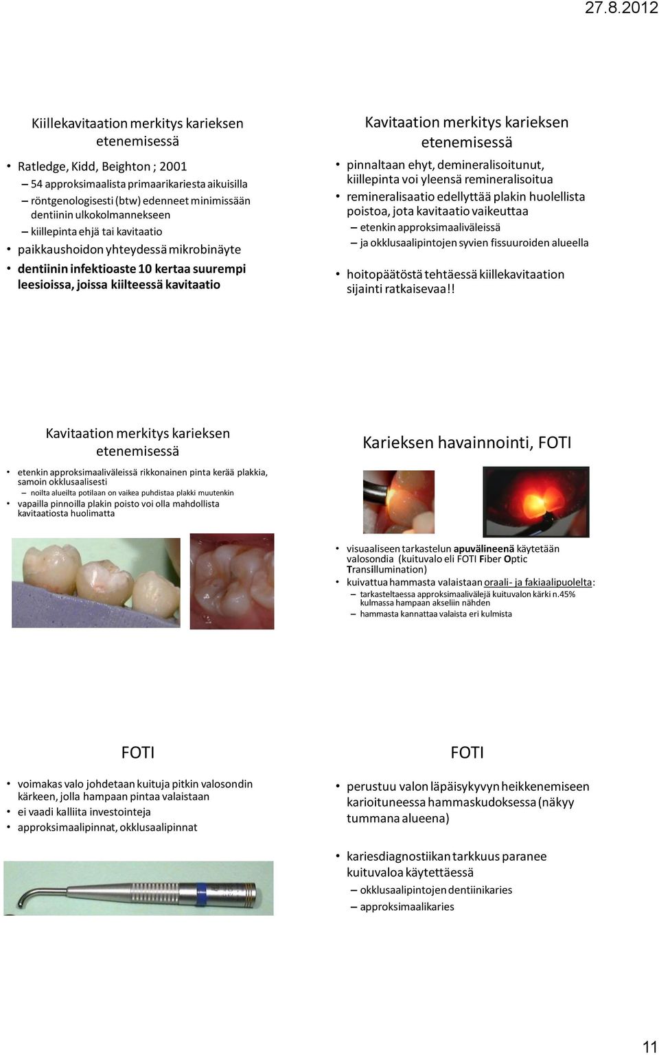 karieksen etenemisessä pinnaltaan ehyt, demineralisoitunut, kiillepinta voi yleensä remineralisoitua remineralisaatio edellyttää plakin huolellista poistoa, jota kavitaatio vaikeuttaa etenkin