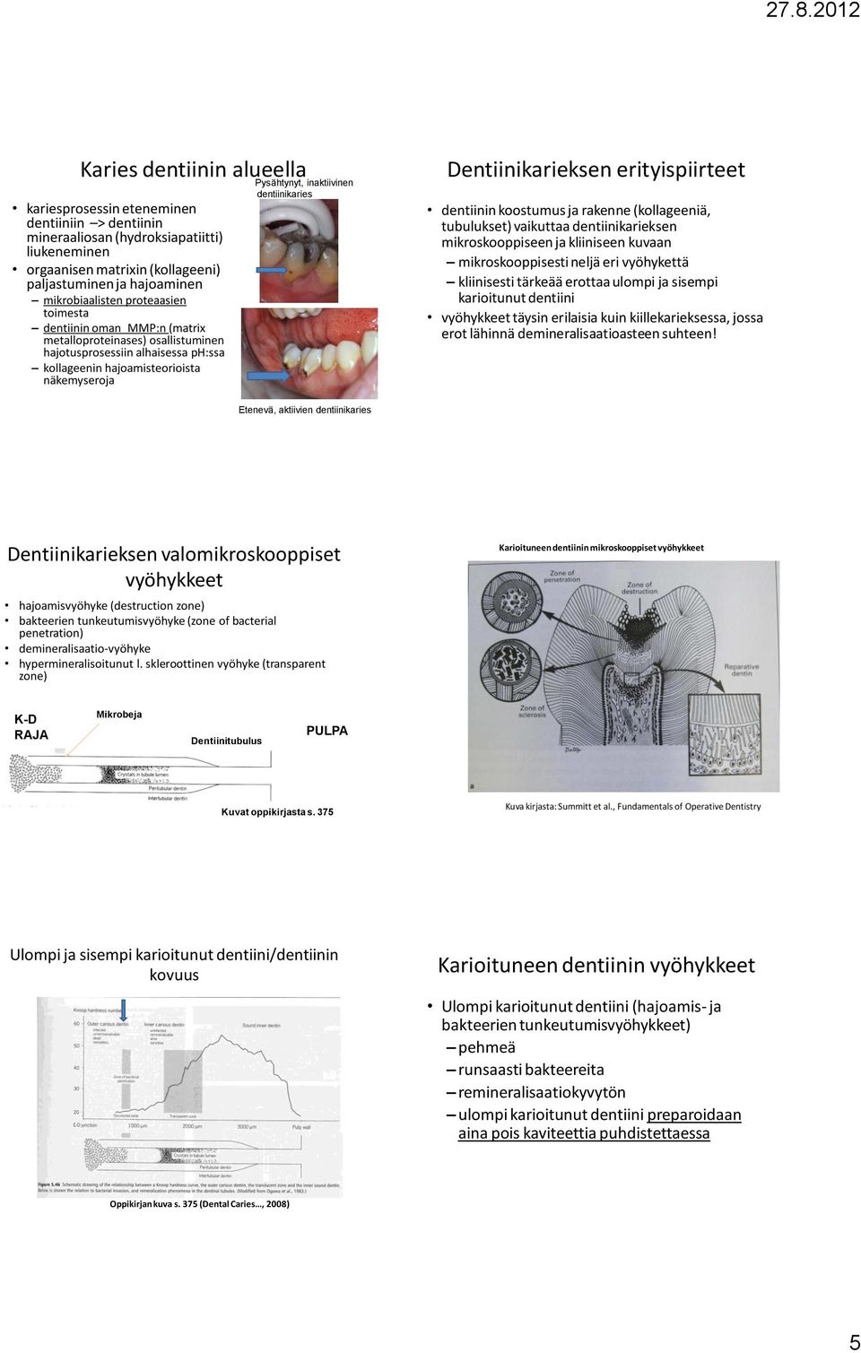 dentiinikaries Dentiinikarieksen erityispiirteet dentiinin koostumus ja rakenne (kollageeniä, tubulukset) vaikuttaa dentiinikarieksen mikroskooppiseen ja kliiniseen kuvaan mikroskooppisesti neljä eri