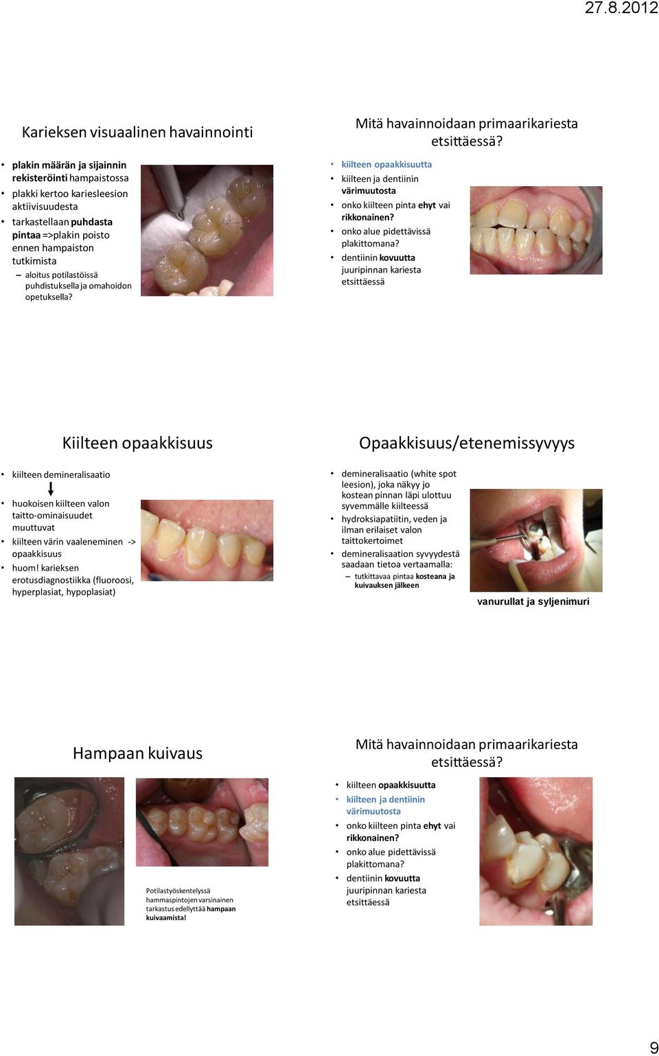 kiilteen opaakkisuutta kiilteen ja dentiinin värimuutosta onko kiilteen pinta ehyt vai rikkonainen? onko alue pidettävissä plakittomana?