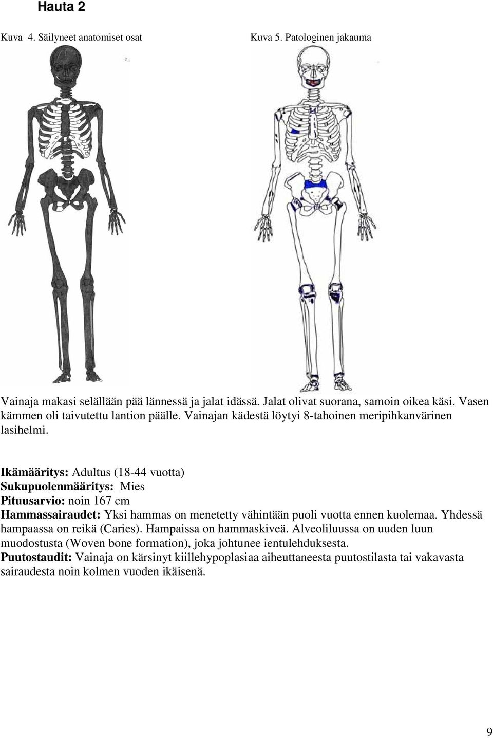 Ikämääritys: Adultus (18-44 vuotta) Sukupuolenmääritys: Mies Pituusarvio: noin 167 cm Hammassairaudet: Yksi hammas on menetetty vähintään puoli vuotta ennen kuolemaa.