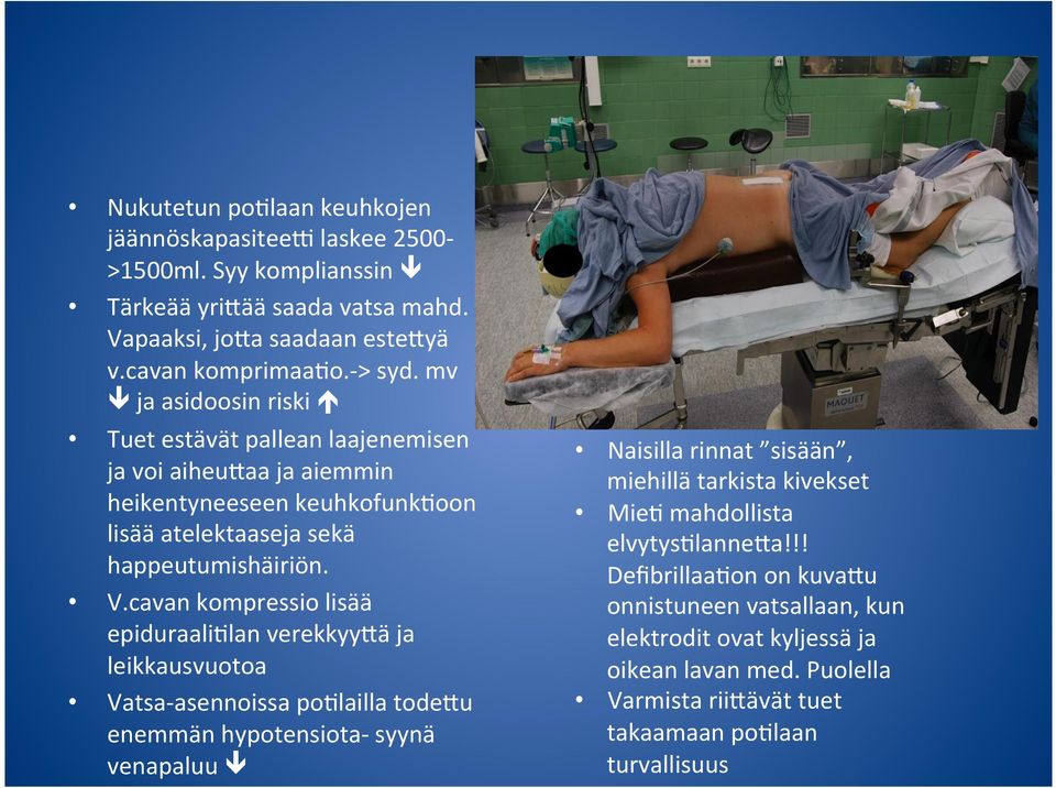 cavan kompressio lisää epiduraali(lan verekkyyfä ja leikkausvuotoa Vatsa- asennoissa po(lailla todefu enemmän hypotensiota- syynä venapaluu ê Naisilla rinnat sisään, miehillä tarkista