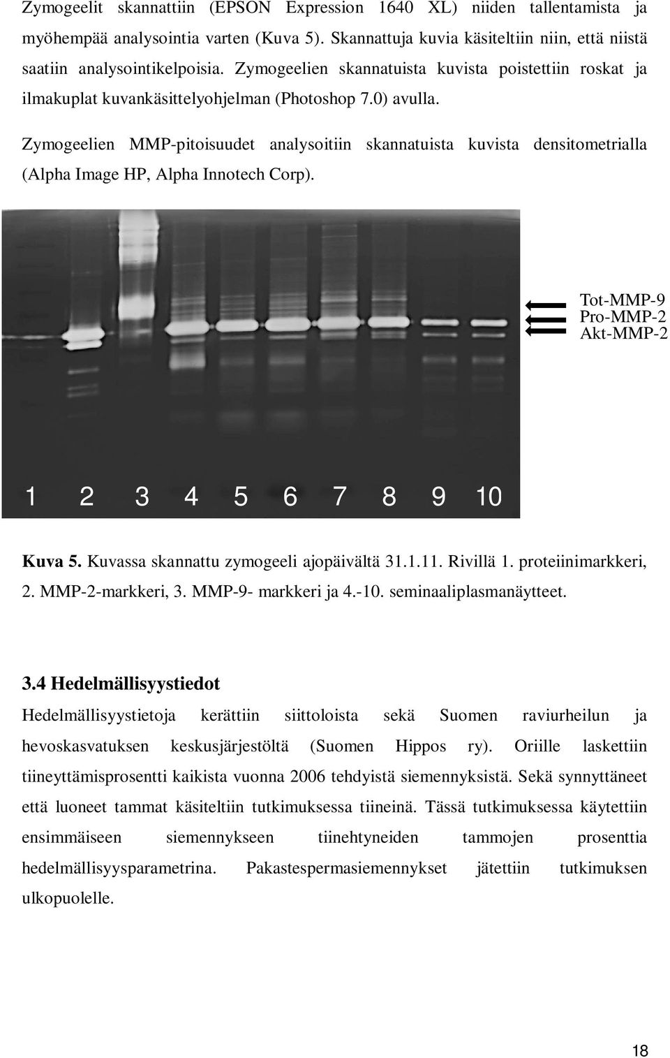 Zymogeelien MMP-pitoisuudet analysoitiin skannatuista kuvista densitometrialla (Alpha Image HP, Alpha Innotech Corp). Tot-MMP-9 Pro-MMP-2 Akt-MMP-2 1 2 3 4 5 6 7 8 9 10 Kuva 5.