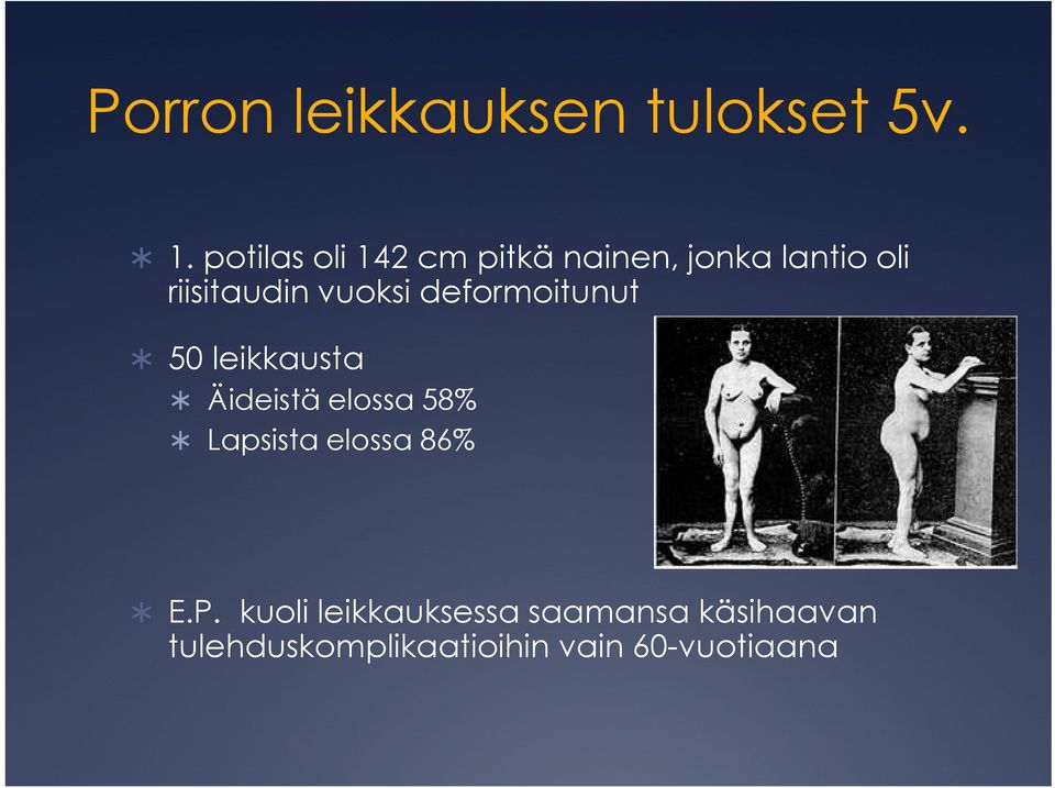 vuoksi deformoitunut 50 leikkausta Äideistä elossa 58% Lapsista